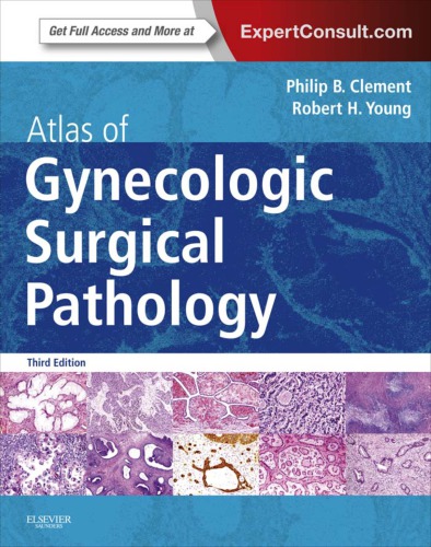 Atlas of Gynecologic Surgical Pathology 2013