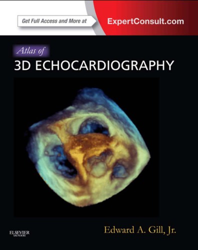 Atlas of 3D Echocardiography 2012