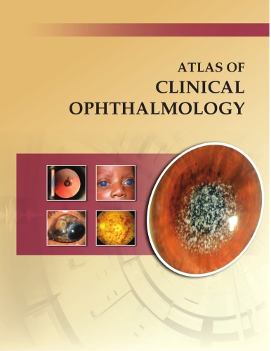 Atlas of Clinical Ophthalmology 2013