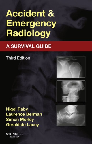 Accident and Emergency Radiology: A Survival Guide 2013