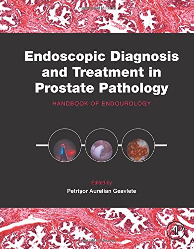 Endoscopic Diagnosis and Treatment in Prostate Pathology: Handbook of Endourology 2016