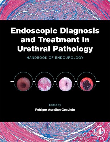 Endoscopic Diagnosis and Treatment in Urethral Pathology: Handbook of Endourology 2015