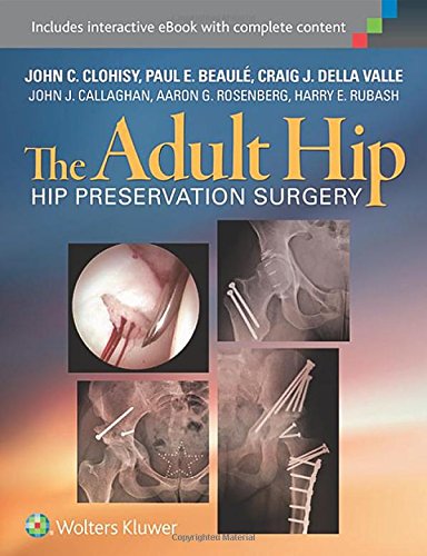 The Adult Hip: Hip Preservation Surgery 2014