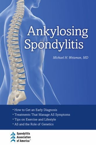Ankylosing Spondylitis 2011