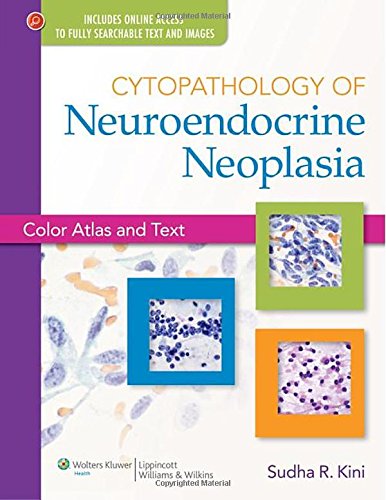Cytopathology of Neuroendocrine Neoplasia: Color Atlas and Text 2013