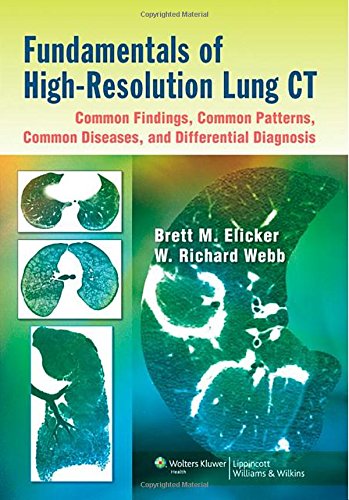 Fundamentals of High-resolution Lung CT: Common Findings, Common Patterns, Common Diseases, and Differential Diagnosis 2013