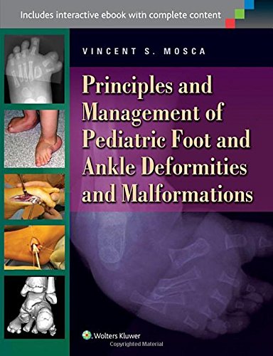 Principles and Management of Pediatric Foot and Ankle Deformities and Malformations 2014