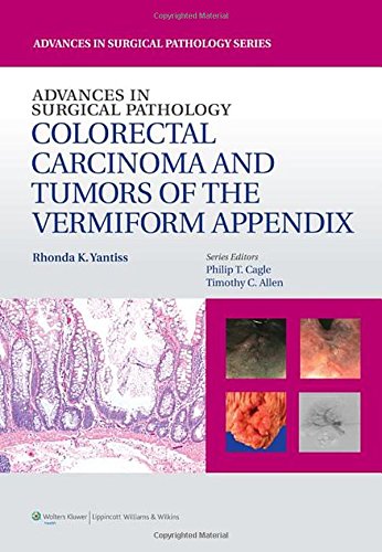 Advances in Surgical Pathology: Colorectal Carcinoma and Tumors of the Vermiform Appendix 2013