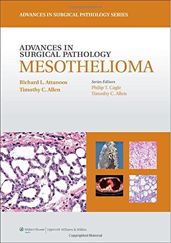 Advances in Surgical Pathology: Mesothelioma 2013
