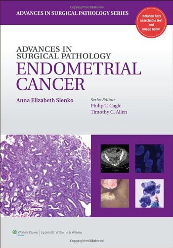 Advances in Surgical Pathology: Endometrial Carcinoma 2012