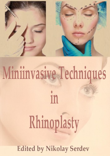 Miniinvasive Techniques in Rhinoplasty 2016