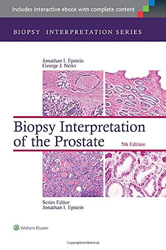 Biopsy Interpretation of the Prostate 2014