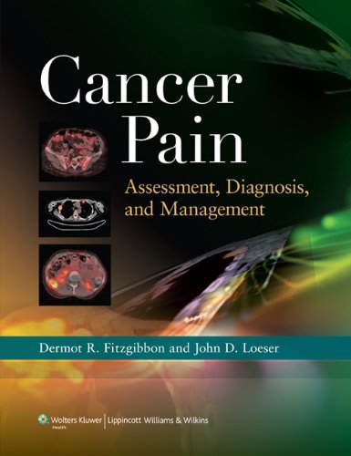 Cancer Pain: Assessment, Diagnosis, and Management 2010