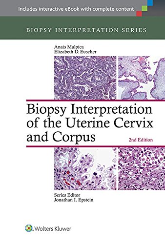 Biopsy Interpretation of the Uterine Cervix and Corpus 2015