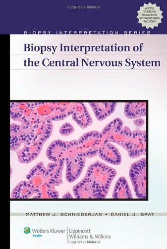 تفسیر بیوپسی از سیستم عصبی مرکزی