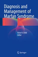 تشخیص و درمان سندرم مارفان