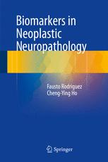 نشانگرهای زیستی در نوروپاتولوژی نئوپلاستیک
