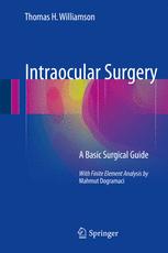 Intraocular Surgery: A Basic Surgical Guide 2016