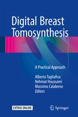Digital Breast Tomosynthesis: A Practical Approach 2016