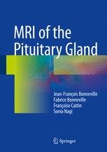 MRI of the Pituitary Gland 2016