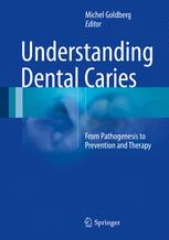 Understanding Dental Caries: From Pathogenesis to Prevention and Therapy 2016
