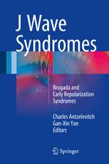 J Wave Syndromes: Brugada and Early Repolarization Syndromes 2016