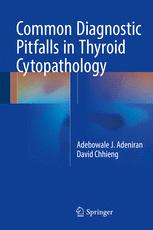 Common Diagnostic Pitfalls in Thyroid Cytopathology 2016