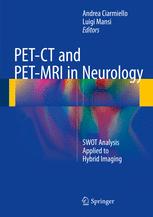PET-CT and PET-MRI in Neurology: SWOT Analysis Applied to Hybrid Imaging 2016
