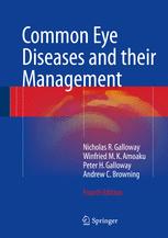 Common Eye Diseases and their Management 2016