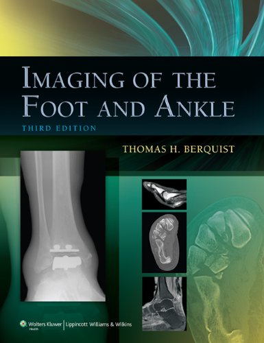 Imaging of the Foot and Ankle 2010