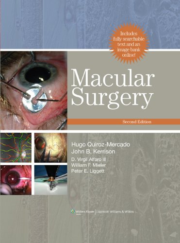 Macular Surgery 2011
