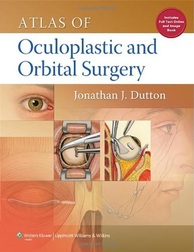 Atlas of Oculoplastic and Orbital Surgery 2012