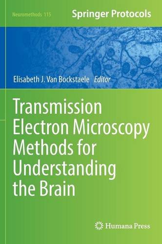 Transmission Electron Microscopy Methods for Understanding the Brain 2016