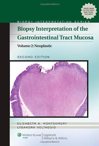 Biopsy Interpretation of the Gastrointestinal Tract Mucosa: Neoplastic 2012