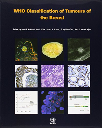 طبقه بندی تومورهای پستان توسط سازمان بهداشت جهانی