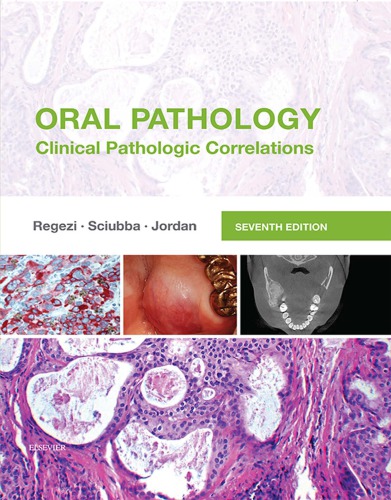 Oral Pathology: Clinical Pathologic Correlations 2016