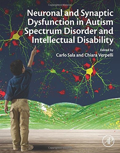 اختلال عملکرد نورونی و سیناپسی در اختلال طیف اوتیسم و ناتوانی ذهنی ۲۰۱۶
