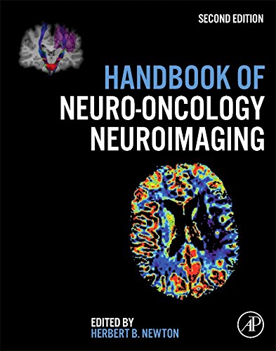 Handbook of Neuro-Oncology Neuroimaging 2016