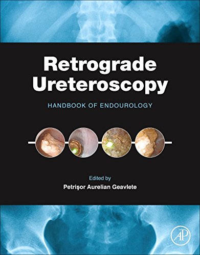 Retrograde Ureteroscopy: Handbook of Endourology 2016
