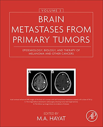 متاستازهای مغزی از تومورهای اولیه، جلد 3: اپیدمیولوژی، زیست شناسی، و درمان ملانوما و سایر سرطان ها