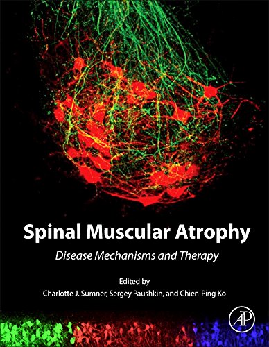 Spinal Muscular Atrophy: Disease Mechanisms and Therapy 2016