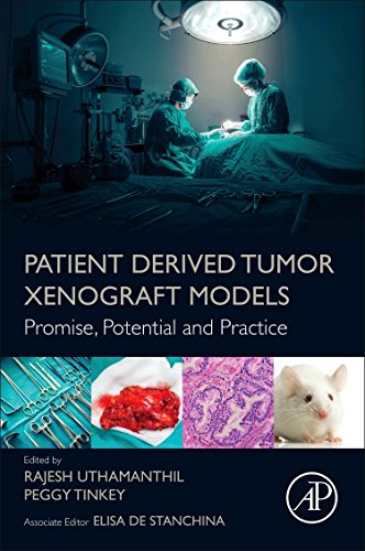 Patient Derived Tumor Xenograft Models: Promise, Potential and Practice 2016