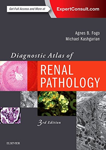 Diagnostic Atlas of Renal Pathology 2016
