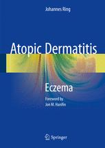 Atopic Dermatitis: Eczema 2016