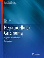 Hepatocellular Carcinoma: Diagnosis and Treatment 2016