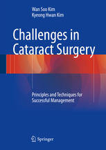 Challenges in Cataract Surgery: Principles and Techniques for Successful Management 2016