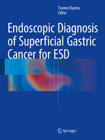Preoperative Diagnosis of Gastric Cancer: Endoscopic Submucosal Dissection 2016