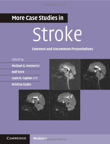 More Case Studies in Stroke: Common and Uncommon Presentations 2014