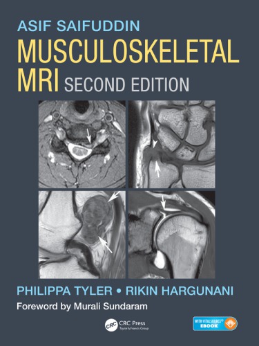 Musculoskeletal MRI 2016