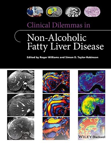Clinical Dilemmas in Non-Alcoholic Fatty Liver Disease 2016